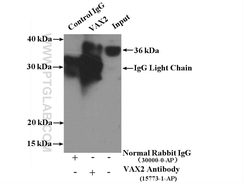 Immunoprecipitation (IP) experiment of Y79 cells using VAX2 Polyclonal antibody (15773-1-AP)