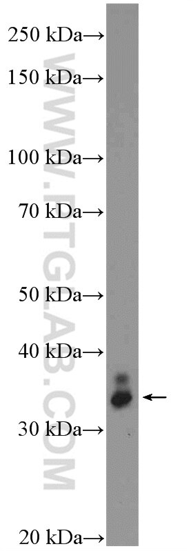 Western Blot (WB) analysis of mouse eye tissue using VAX2 Polyclonal antibody (15773-1-AP)