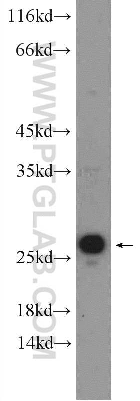 Western Blot (WB) analysis of mouse liver tissue using VBP1 Polyclonal antibody (14345-1-AP)
