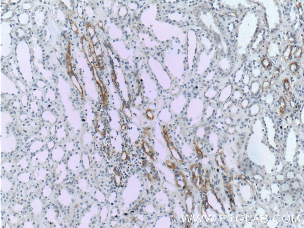 IHC staining of human kidney using 11444-1-AP