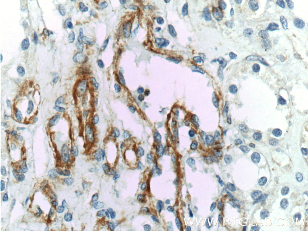 Immunohistochemistry (IHC) staining of human kidney tissue using VCAM-1 Polyclonal antibody (11444-1-AP)