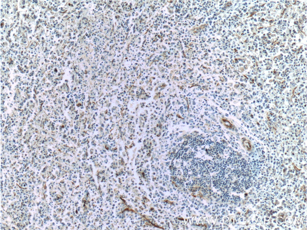 Immunohistochemistry (IHC) staining of human spleen tissue using VCAM-1 Polyclonal antibody (11444-1-AP)