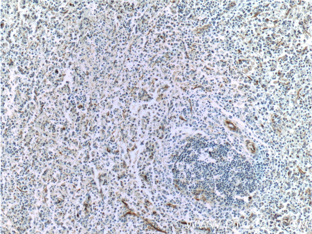 VCAM-1 Polyclonal antibody