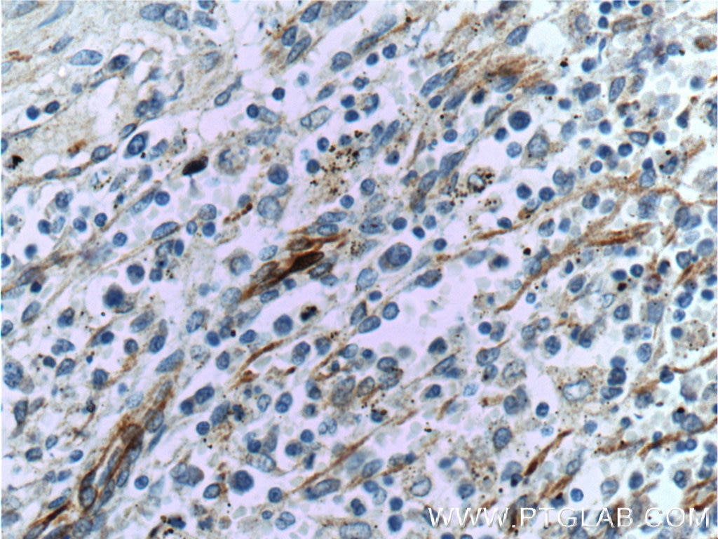 Immunohistochemistry (IHC) staining of human spleen tissue using VCAM-1 Polyclonal antibody (11444-1-AP)