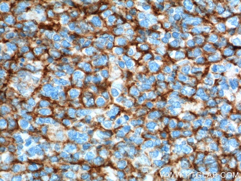 VCAM-1 Polyclonal antibody