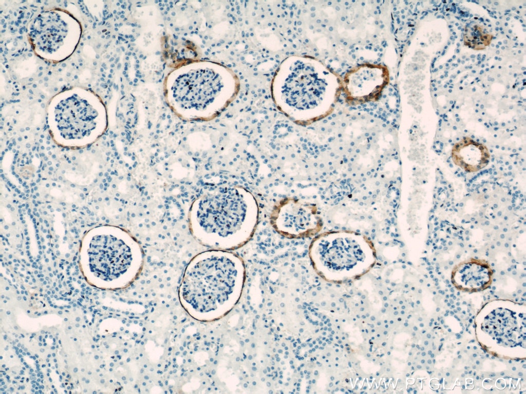 Immunohistochemistry (IHC) staining of human kidney tissue using VCAM-1 Polyclonal antibody (11444-1-AP)