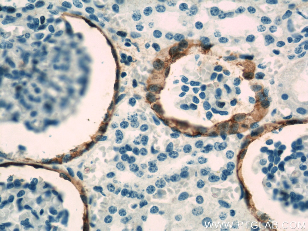 Immunohistochemistry (IHC) staining of human kidney tissue using VCAM-1 Polyclonal antibody (11444-1-AP)