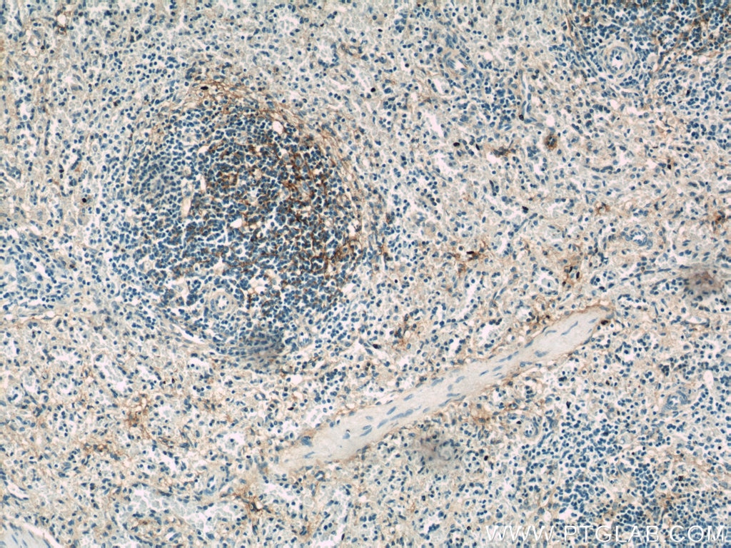 Immunohistochemistry (IHC) staining of human spleen tissue using VCAM-1 Polyclonal antibody (11444-1-AP)