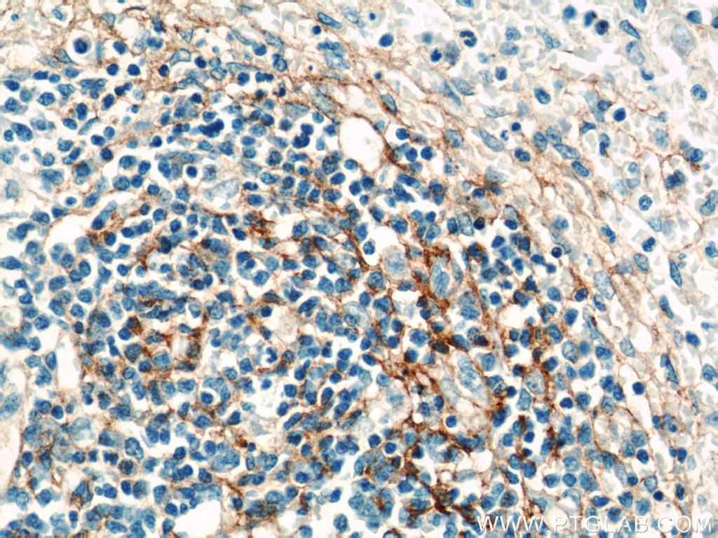 Immunohistochemistry (IHC) staining of human spleen tissue using VCAM-1 Polyclonal antibody (11444-1-AP)