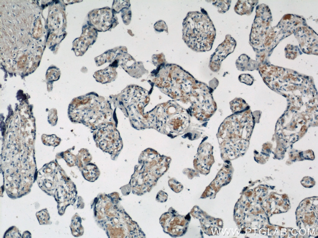 IHC staining of human placenta using 11444-1-AP