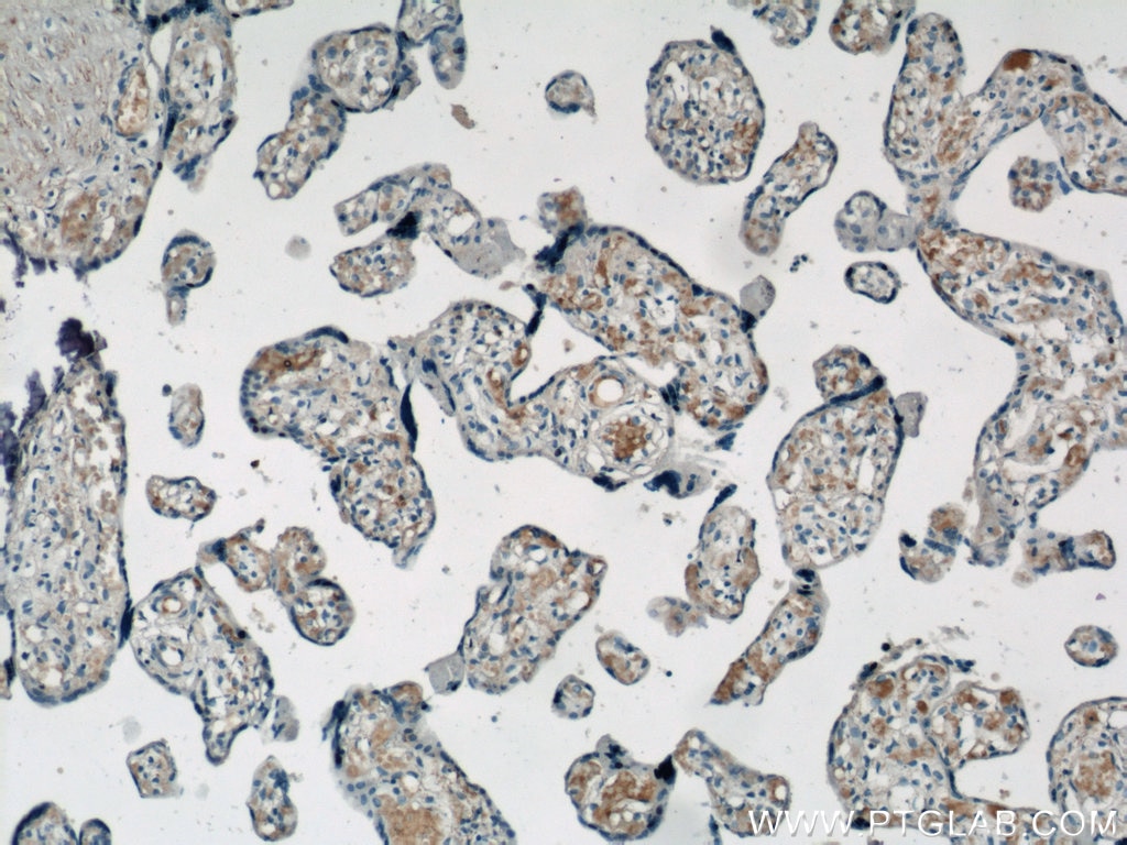 Immunohistochemistry (IHC) staining of human placenta tissue using VCAM-1 Polyclonal antibody (11444-1-AP)