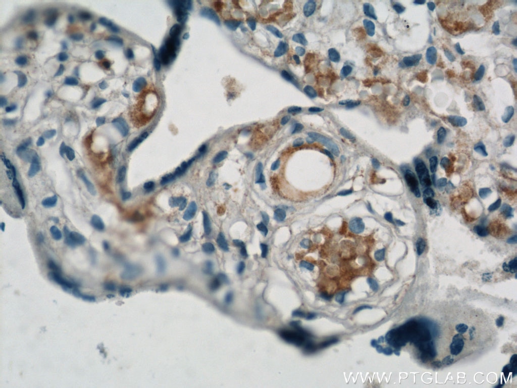 Immunohistochemistry (IHC) staining of human placenta tissue using VCAM-1 Polyclonal antibody (11444-1-AP)