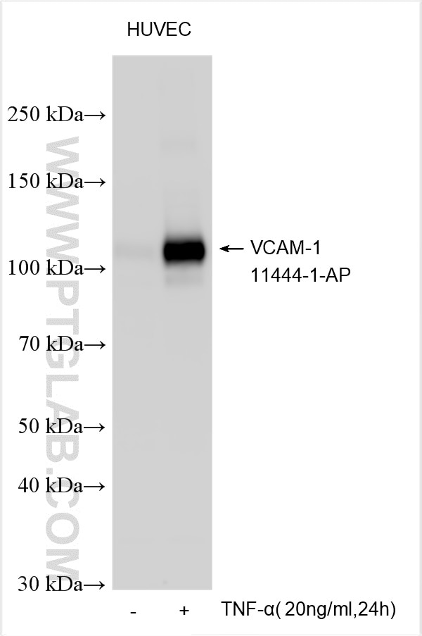 Western Blot (WB) analysis of various lysates using VCAM-1 Polyclonal antibody (11444-1-AP)