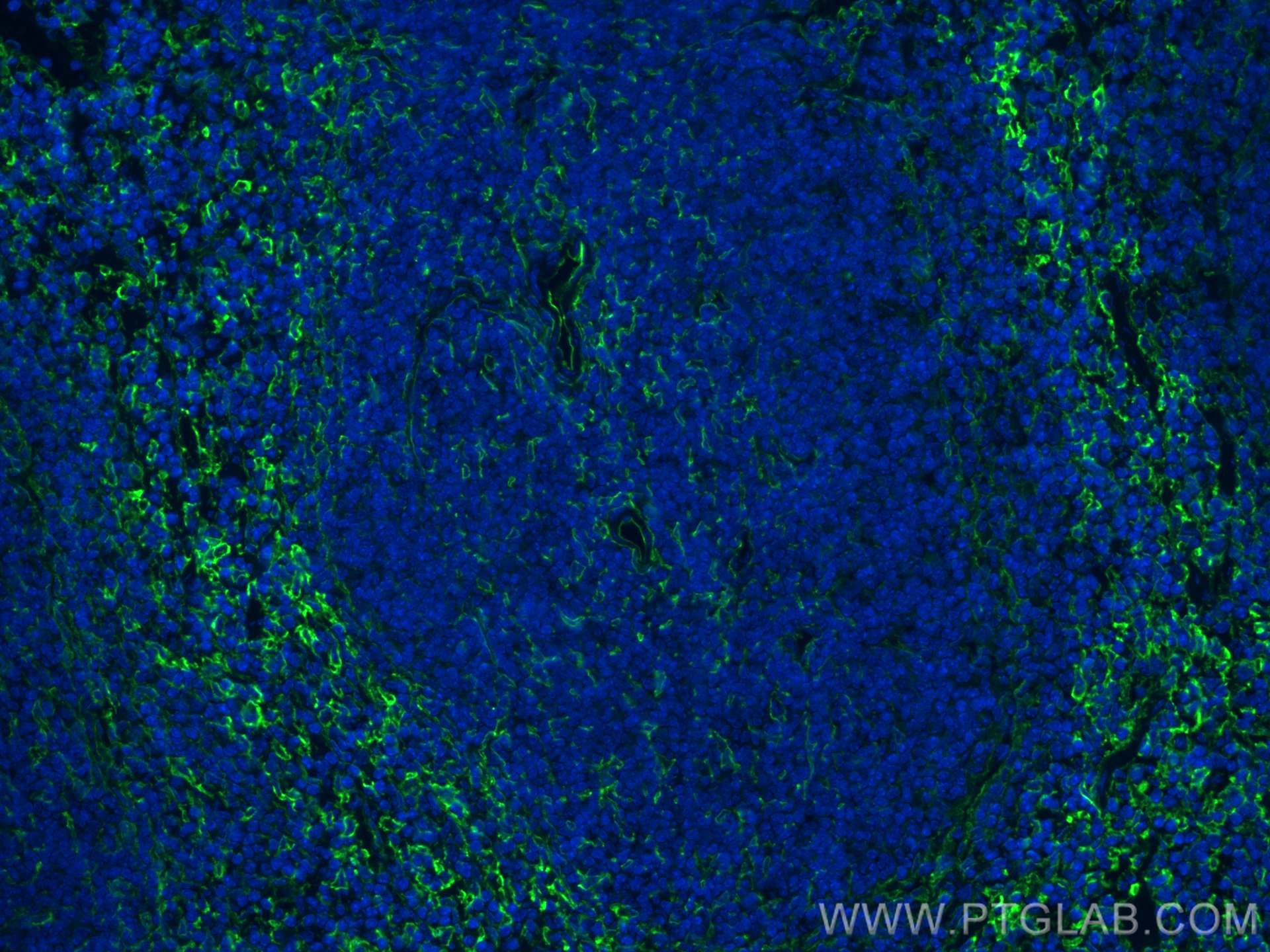 Immunofluorescence (IF) / fluorescent staining of mouse spleen tissue using VCAM-1 Polyclonal antibody (30958-1-AP)