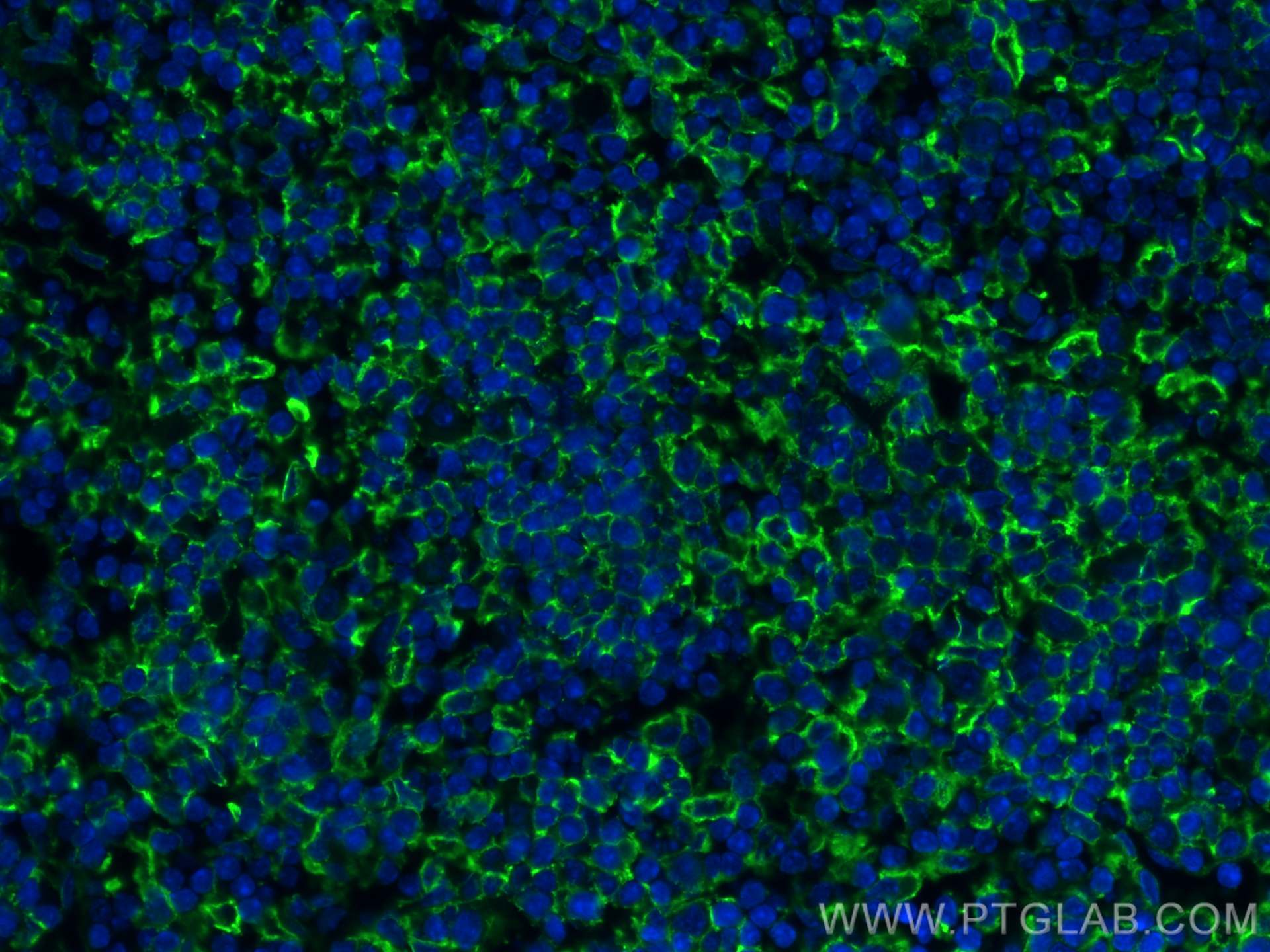 Immunofluorescence (IF) / fluorescent staining of mouse spleen tissue using VCAM-1 Polyclonal antibody (30958-1-AP)