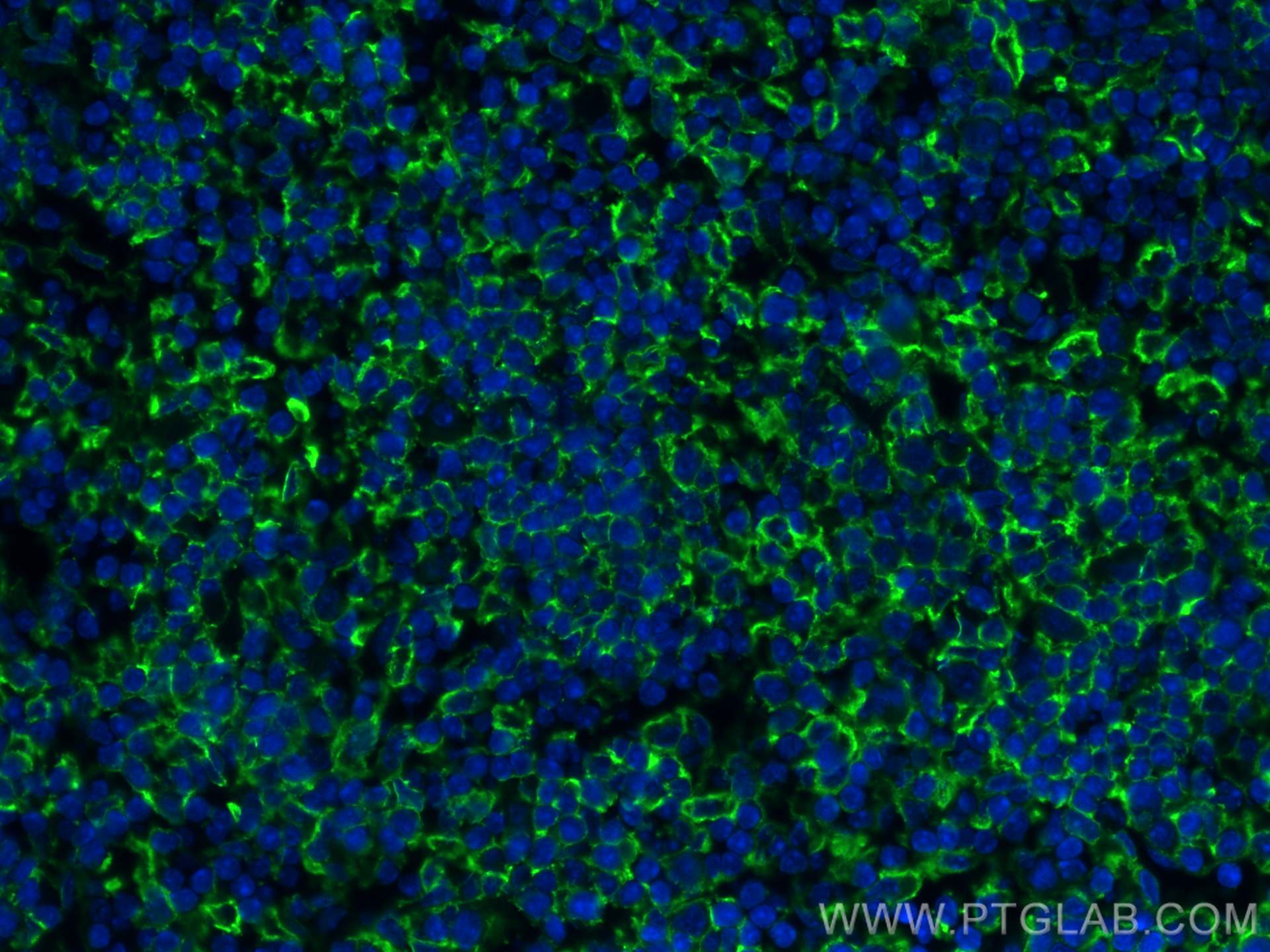 Immunofluorescence (IF) / fluorescent staining of mouse spleen tissue using VCAM-1/CD106 Polyclonal antibody (30958-1-AP)