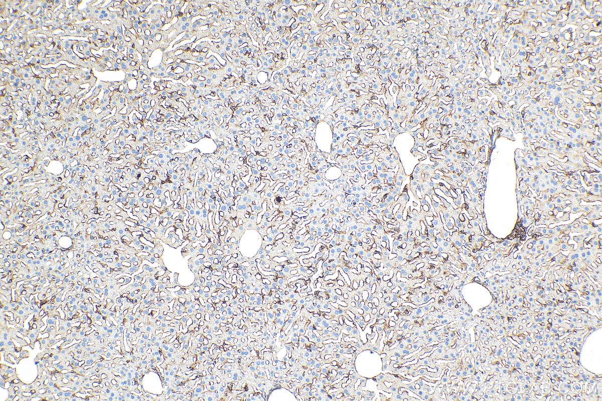 Immunohistochemistry (IHC) staining of mouse liver tissue using VCAM-1 Polyclonal antibody (30958-1-AP)