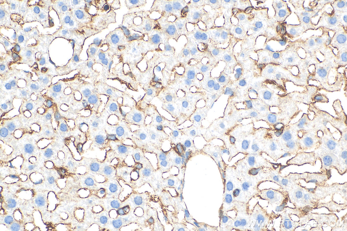 Immunohistochemistry (IHC) staining of mouse liver tissue using VCAM-1 Polyclonal antibody (30958-1-AP)