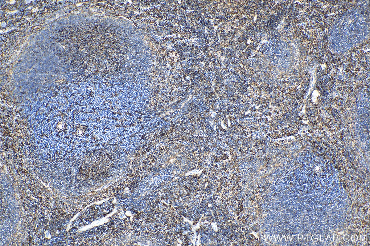 IHC staining of mouse spleen using 30958-1-AP