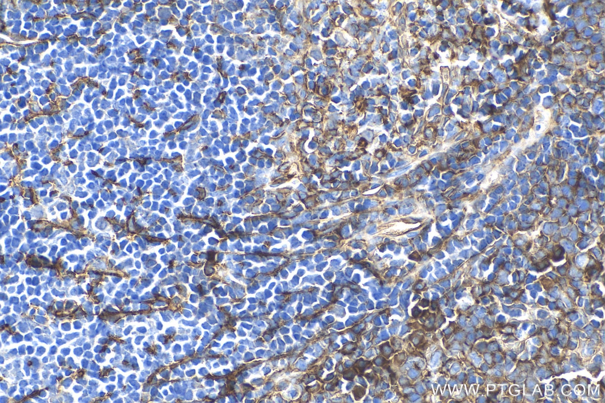 Immunohistochemistry (IHC) staining of mouse spleen tissue using VCAM-1 Polyclonal antibody (30958-1-AP)