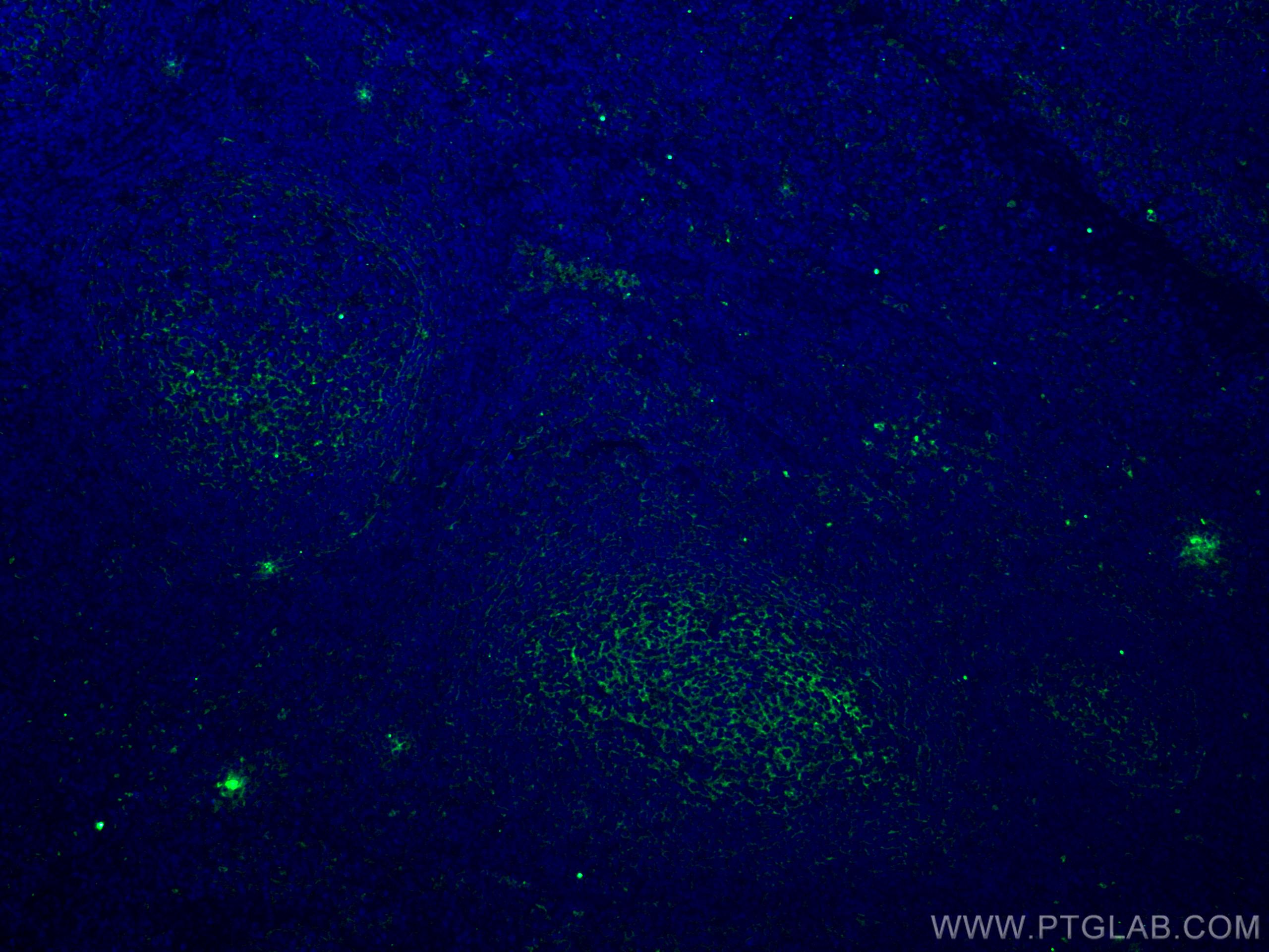 Immunofluorescence (IF) / fluorescent staining of human tonsillitis tissue using VCAM-1 Monoclonal antibody (66294-1-Ig)