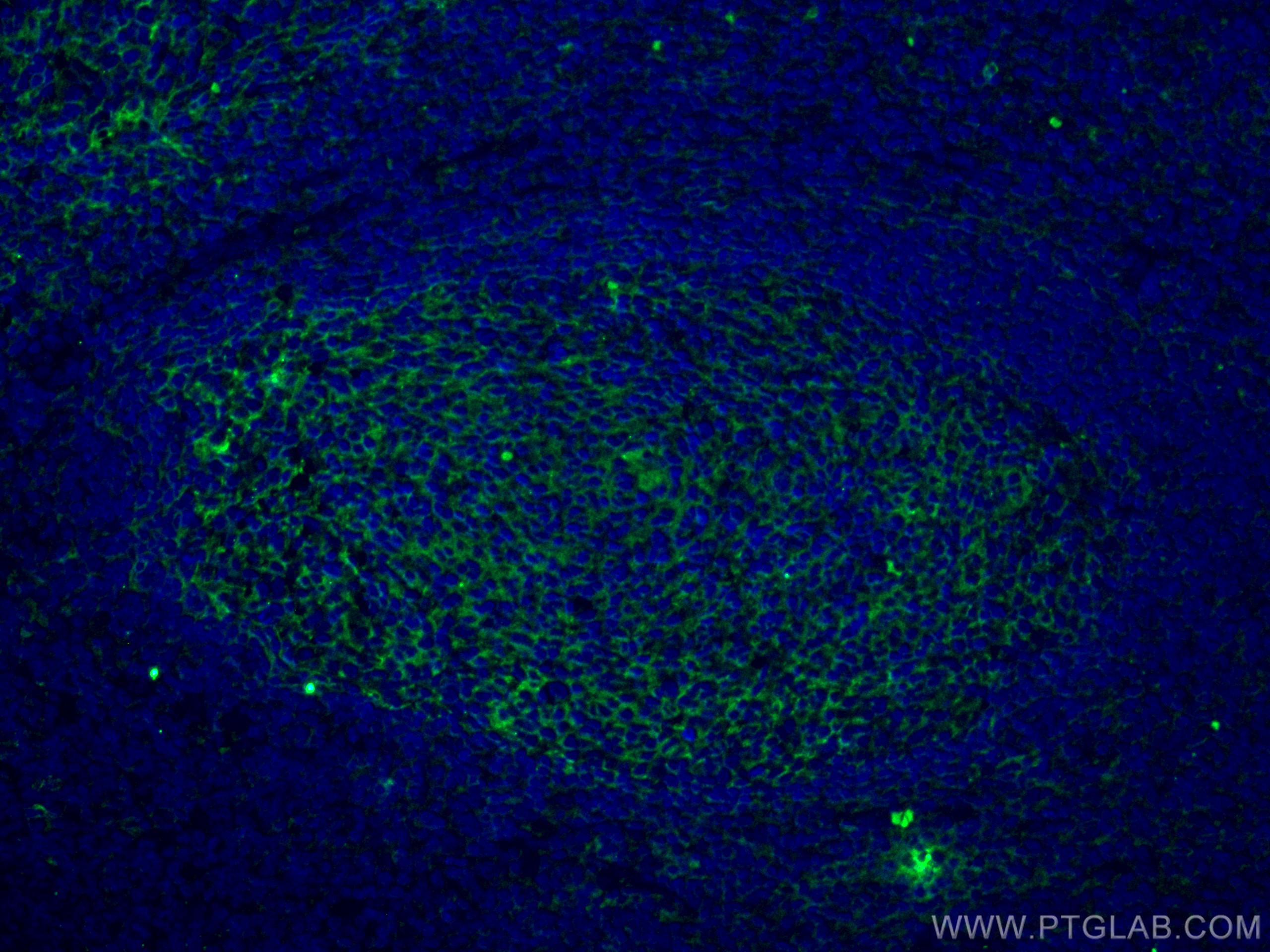 Immunofluorescence (IF) / fluorescent staining of human tonsillitis tissue using VCAM-1 Monoclonal antibody (66294-1-Ig)
