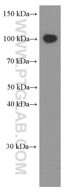 VCAM-1 Monoclonal antibody