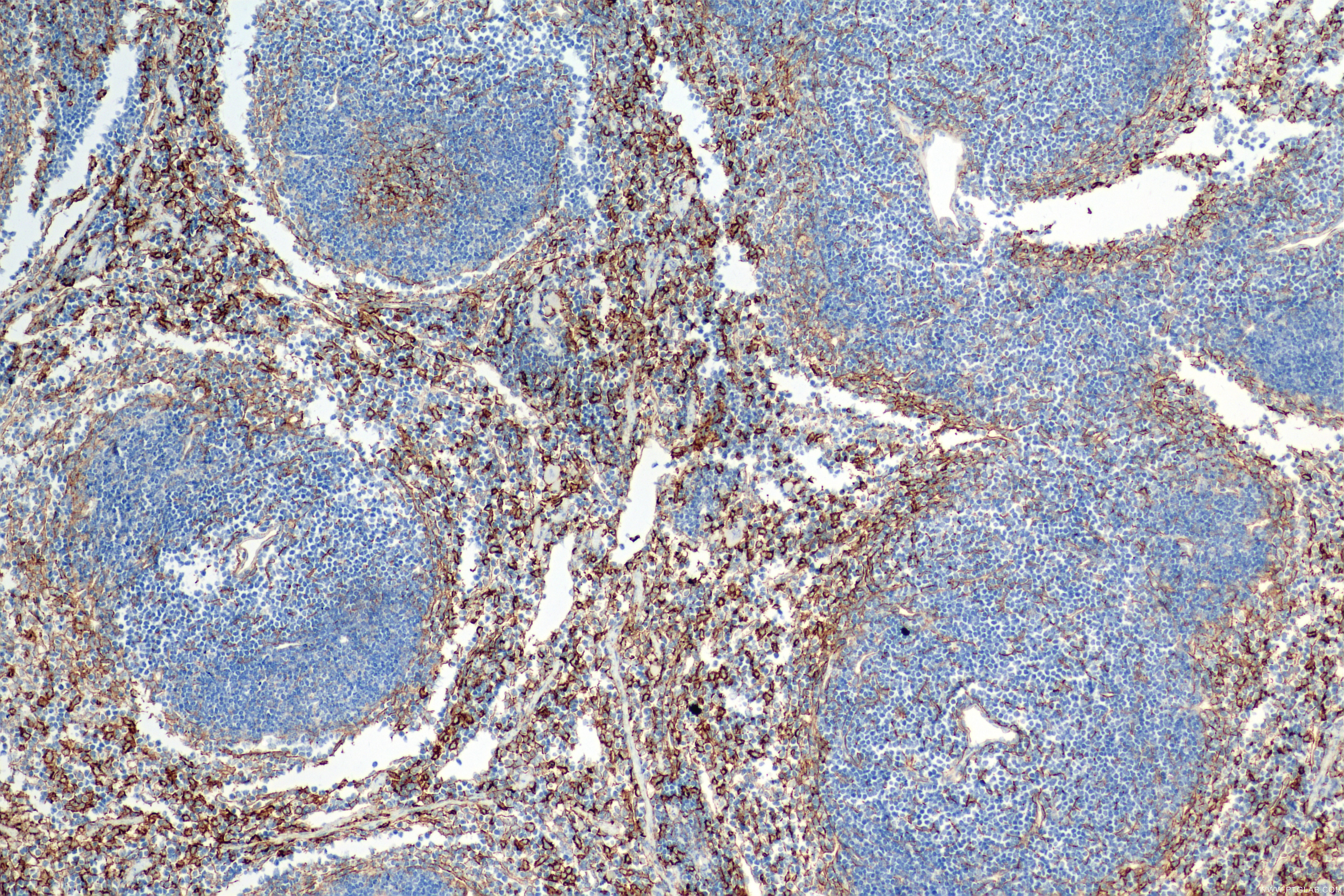 Immunohistochemistry (IHC) staining of mouse spleen tissue using VCAM-1/CD106 Recombinant antibody (83719-1-RR)