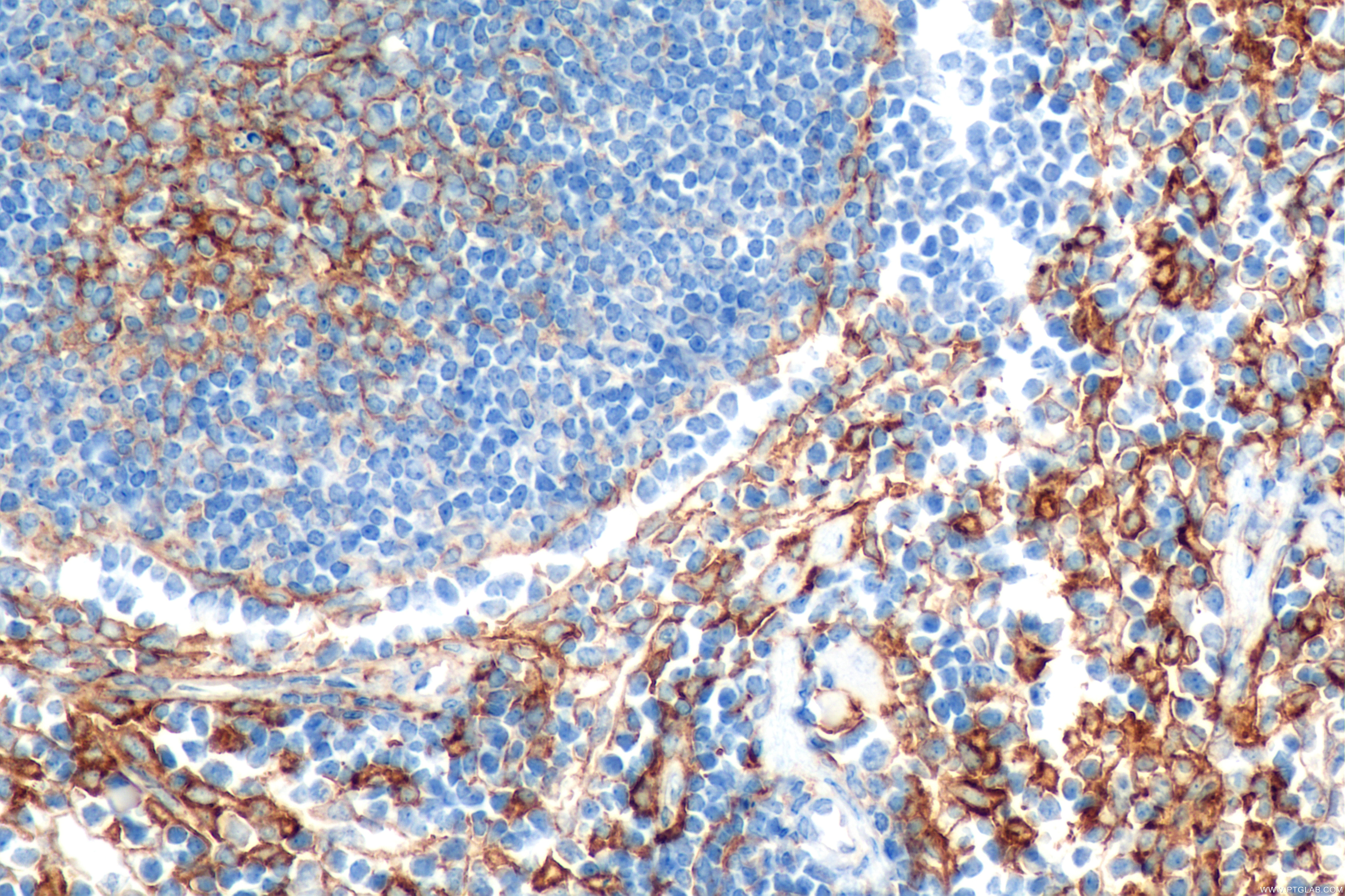 Immunohistochemistry (IHC) staining of mouse spleen tissue using VCAM-1/CD106 Recombinant antibody (83719-1-RR)