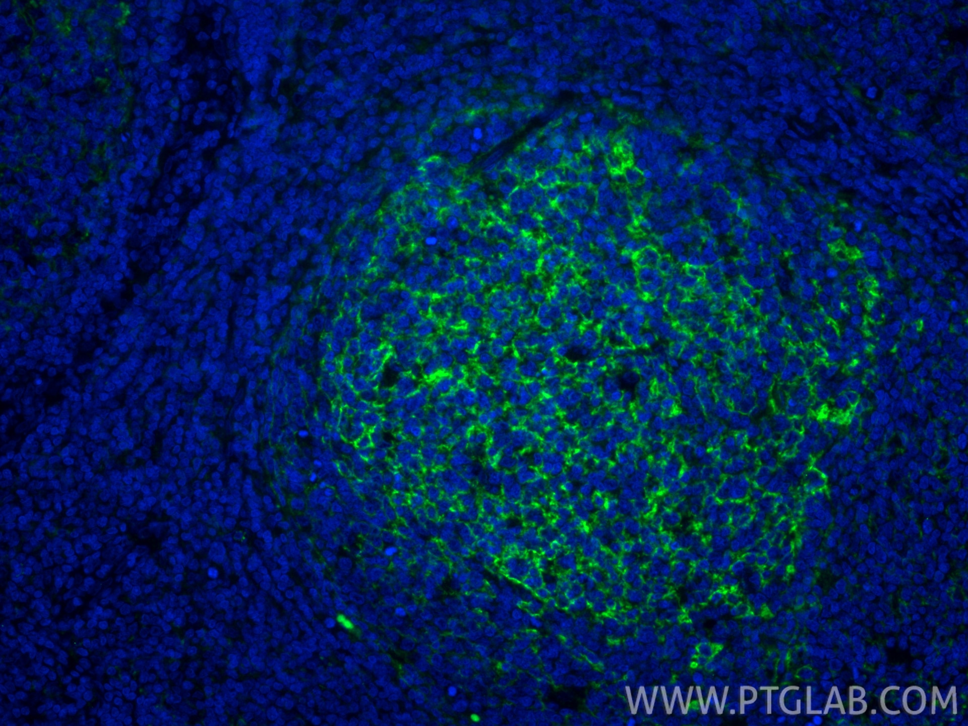 Immunofluorescence (IF) / fluorescent staining of human tonsillitis tissue using VCAM-1/CD106 Recombinant monoclonal antibody (84249-4-RR)