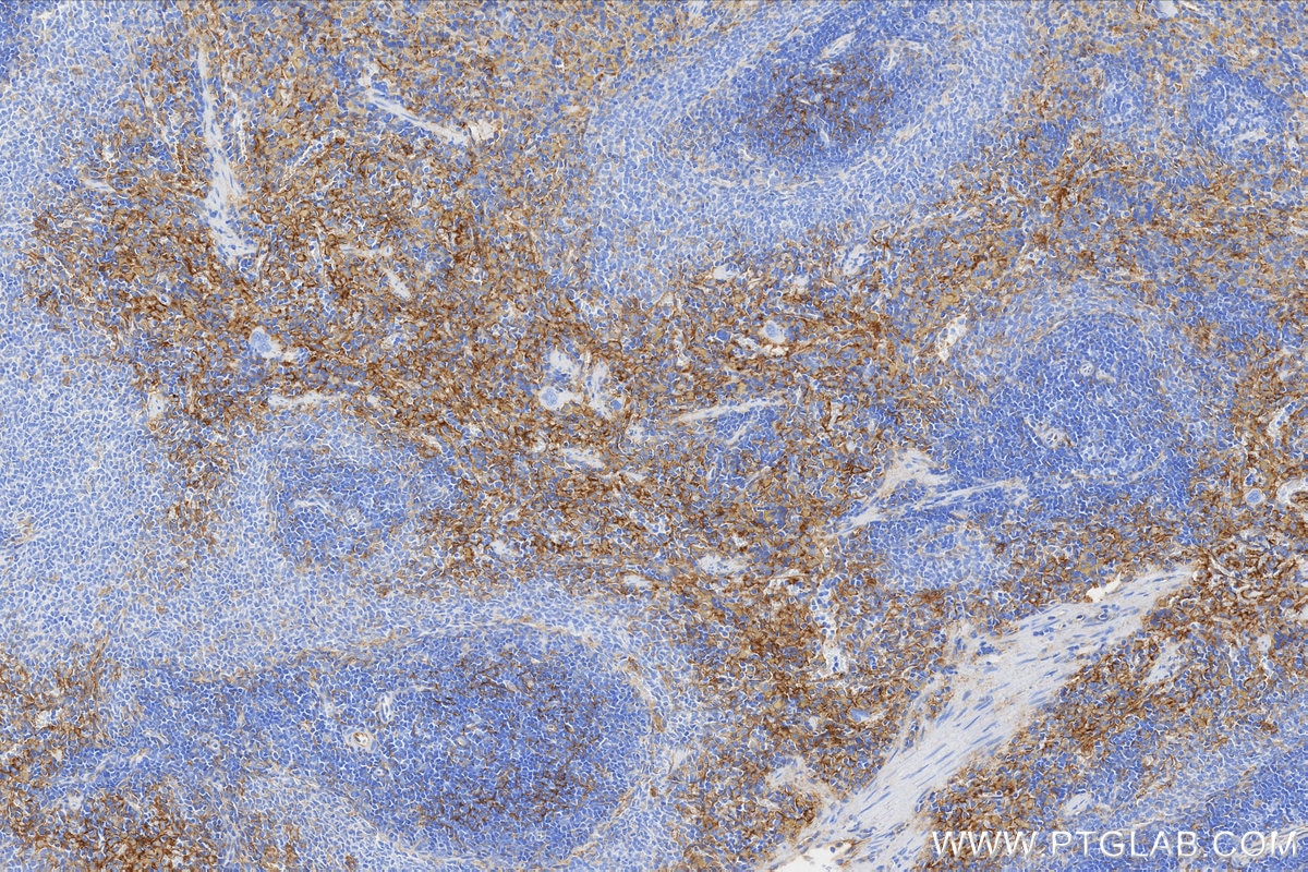 Immunohistochemistry (IHC) staining of rat spleen tissue using VCAM-1/CD106 Recombinant monoclonal antibody (86797-1-RR)