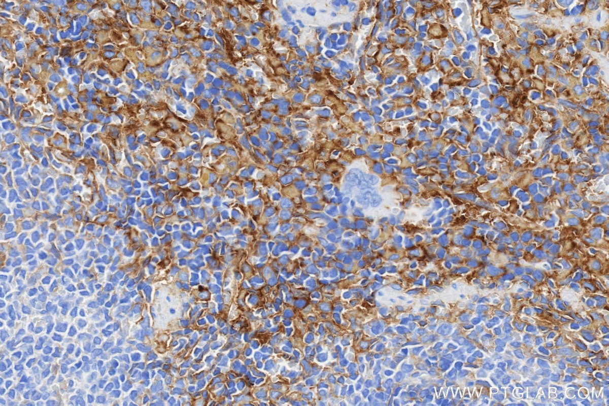 Immunohistochemistry (IHC) staining of rat spleen tissue using VCAM-1/CD106 Recombinant monoclonal antibody (86797-1-RR)