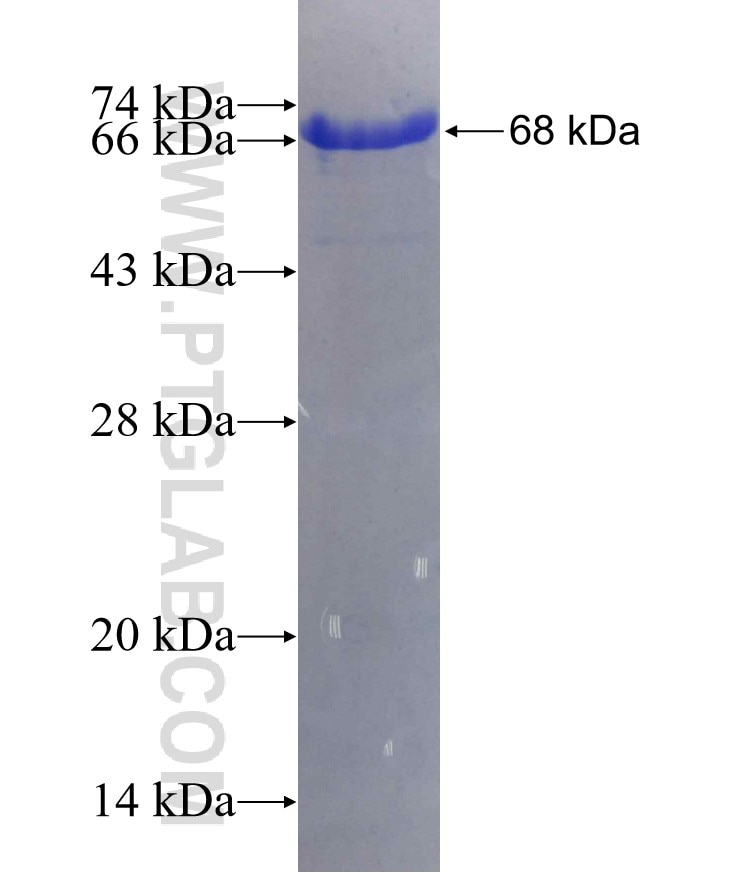 VCAM-1 fusion protein Ag1993 SDS-PAGE