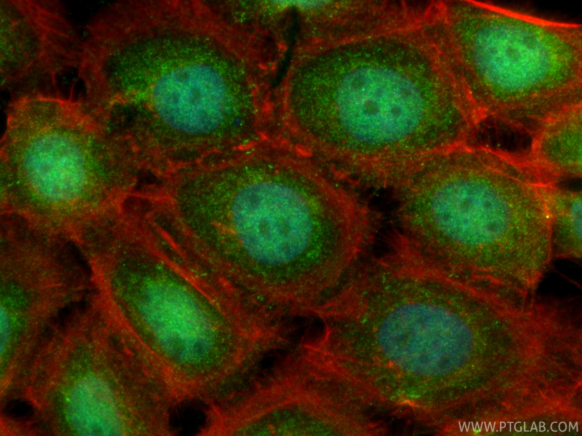 Immunofluorescence (IF) / fluorescent staining of A431 cells using VCP Polyclonal antibody (10736-1-AP)