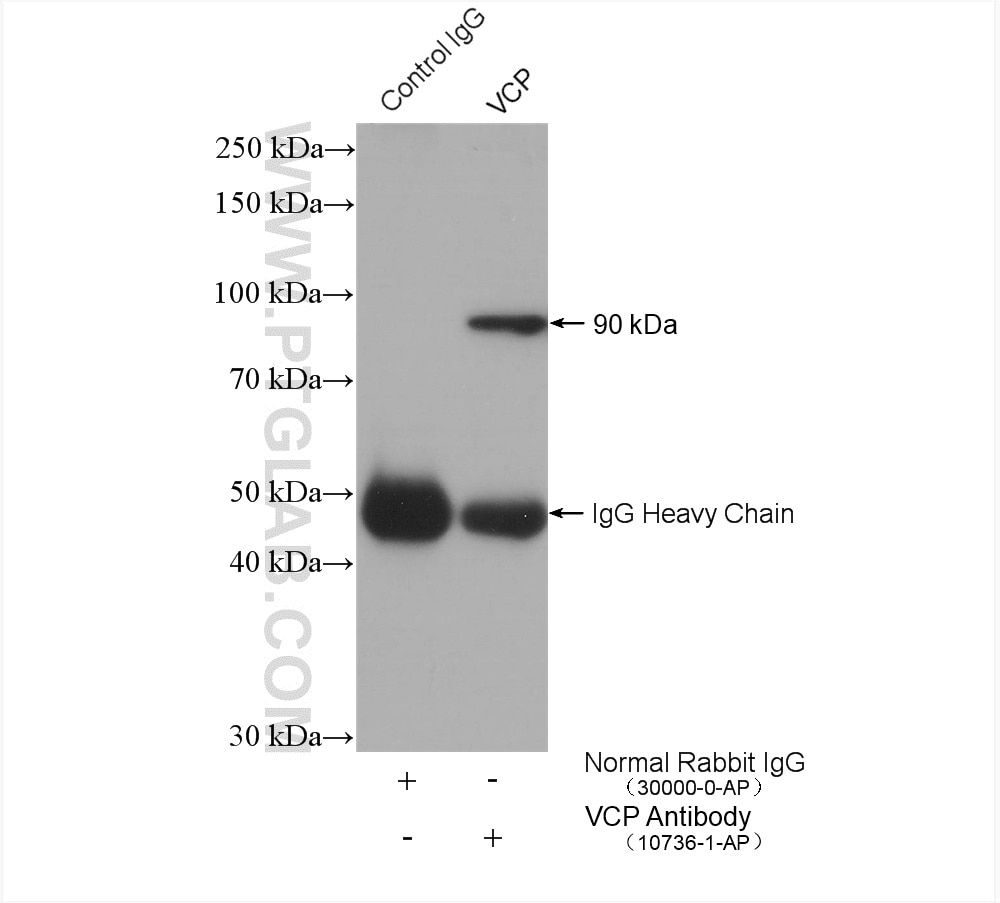 Immunoprecipitation (IP) experiment of mouse brain tissue using VCP Polyclonal antibody (10736-1-AP)
