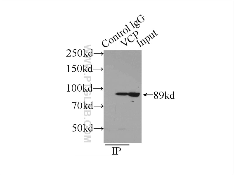Immunoprecipitation (IP) experiment of HeLa cells using VCP Polyclonal antibody (10736-1-AP)