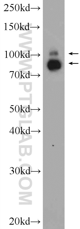 Western Blot (WB) analysis of rat lung tissue using VCP Polyclonal antibody (10736-1-AP)