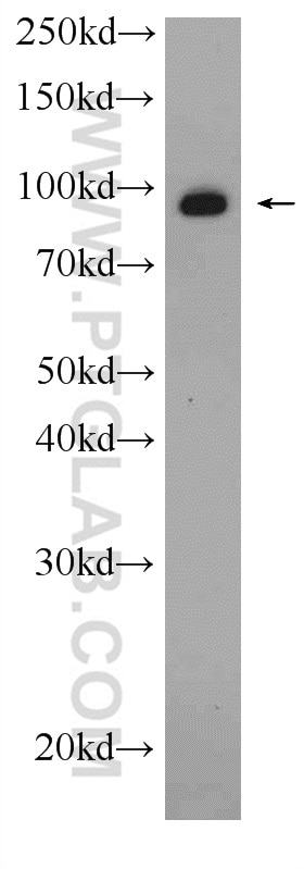 Western Blot (WB) analysis of mouse thymus tissue using VCP Polyclonal antibody (10736-1-AP)