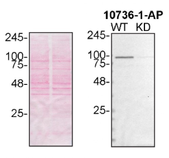 Western Blot (WB) analysis of U2OS cells using VCP Polyclonal antibody (10736-1-AP)