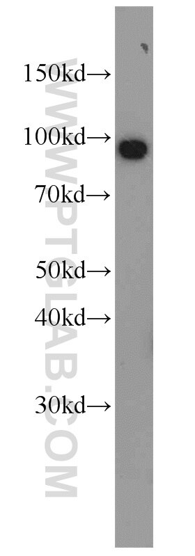 Western Blot (WB) analysis of human brain tissue using VCP Polyclonal antibody (10736-1-AP)