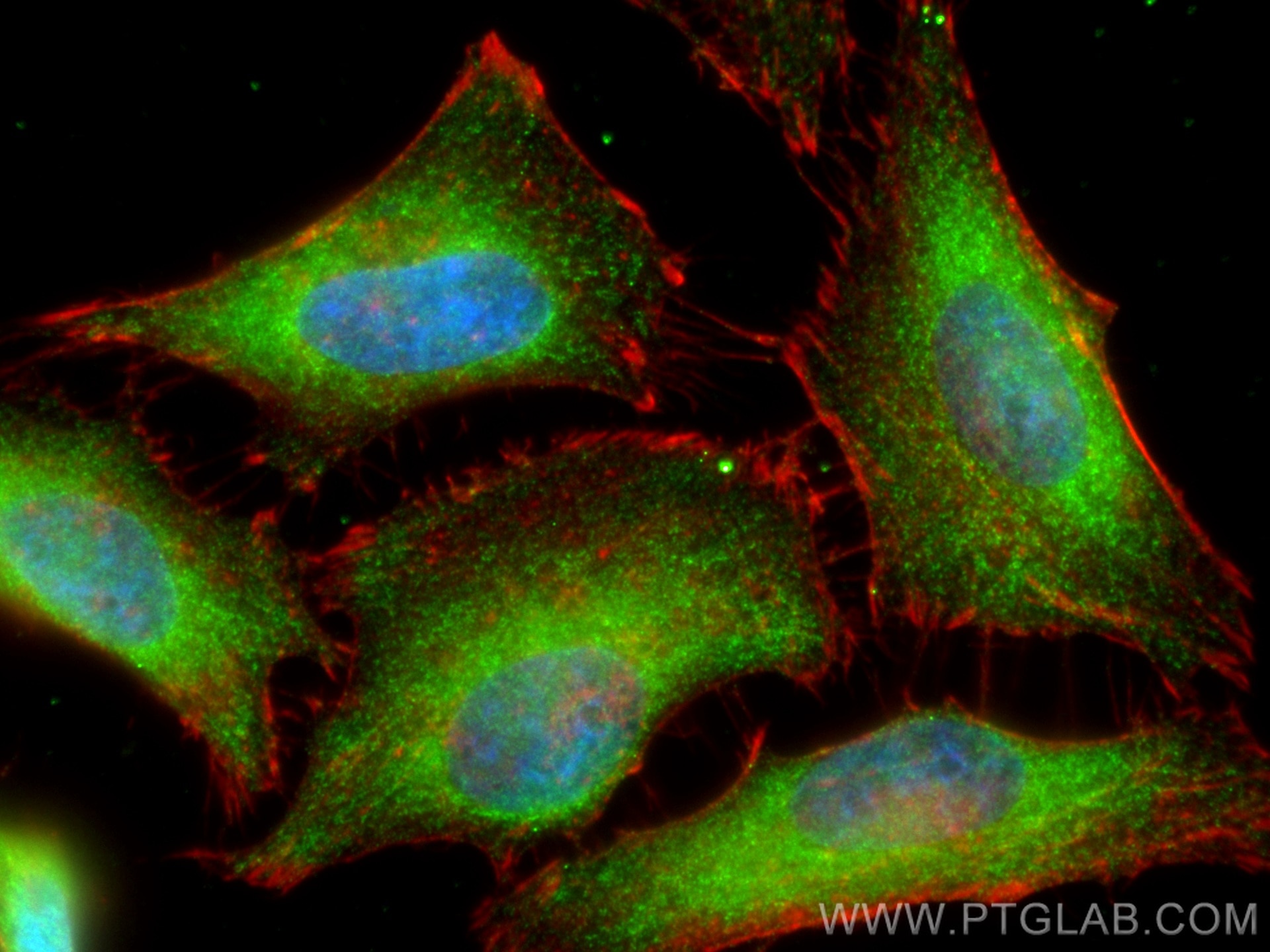 Immunofluorescence (IF) / fluorescent staining of HeLa cells using VCP Monoclonal antibody (60316-1-Ig)