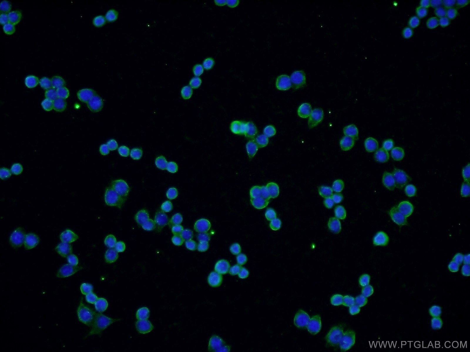 Immunofluorescence (IF) / fluorescent staining of RAW 264.7 cells using VCP Monoclonal antibody (60316-1-Ig)
