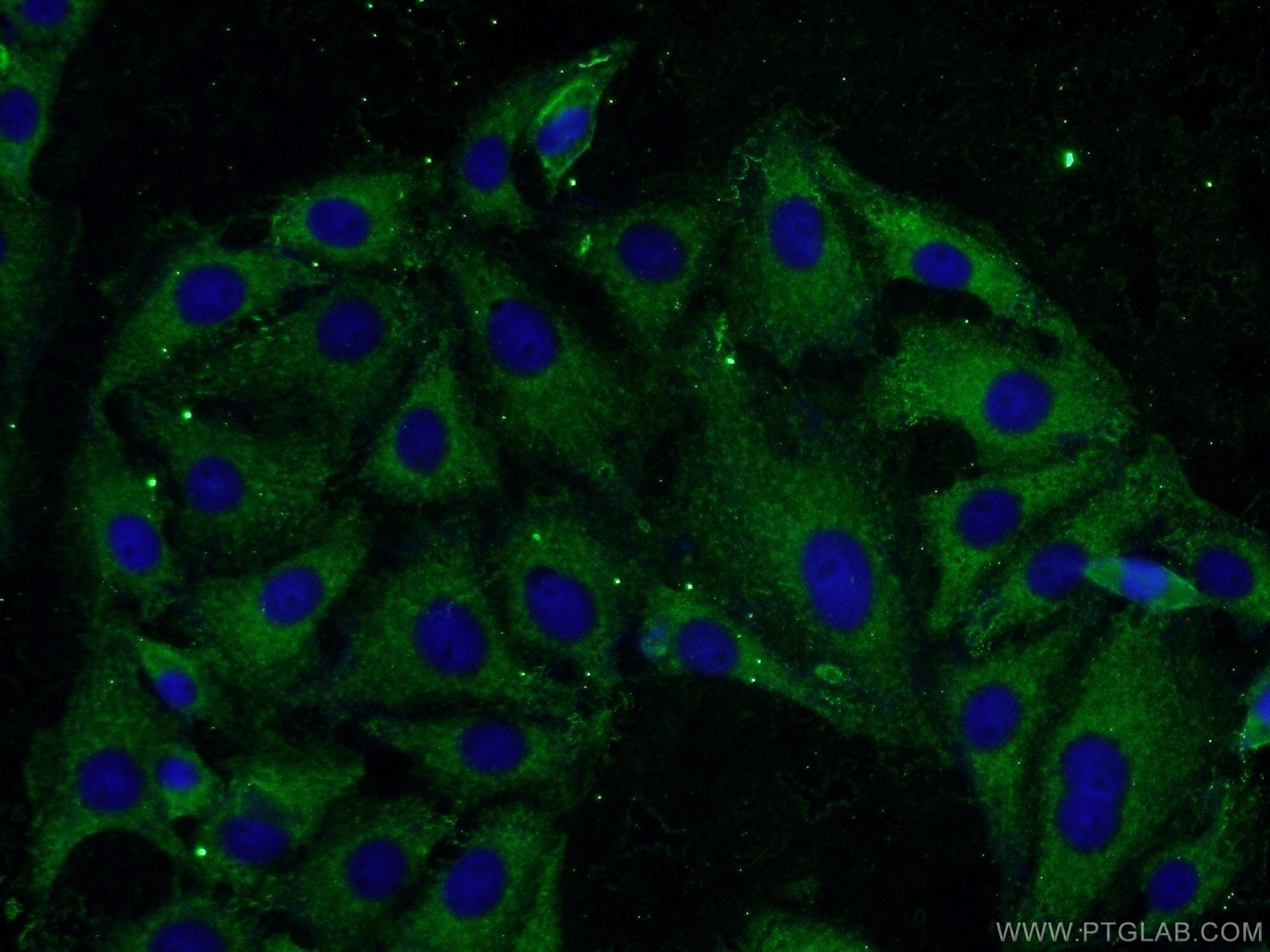 Immunofluorescence (IF) / fluorescent staining of SH-SY5Y cells using VCP Monoclonal antibody (60316-1-Ig)