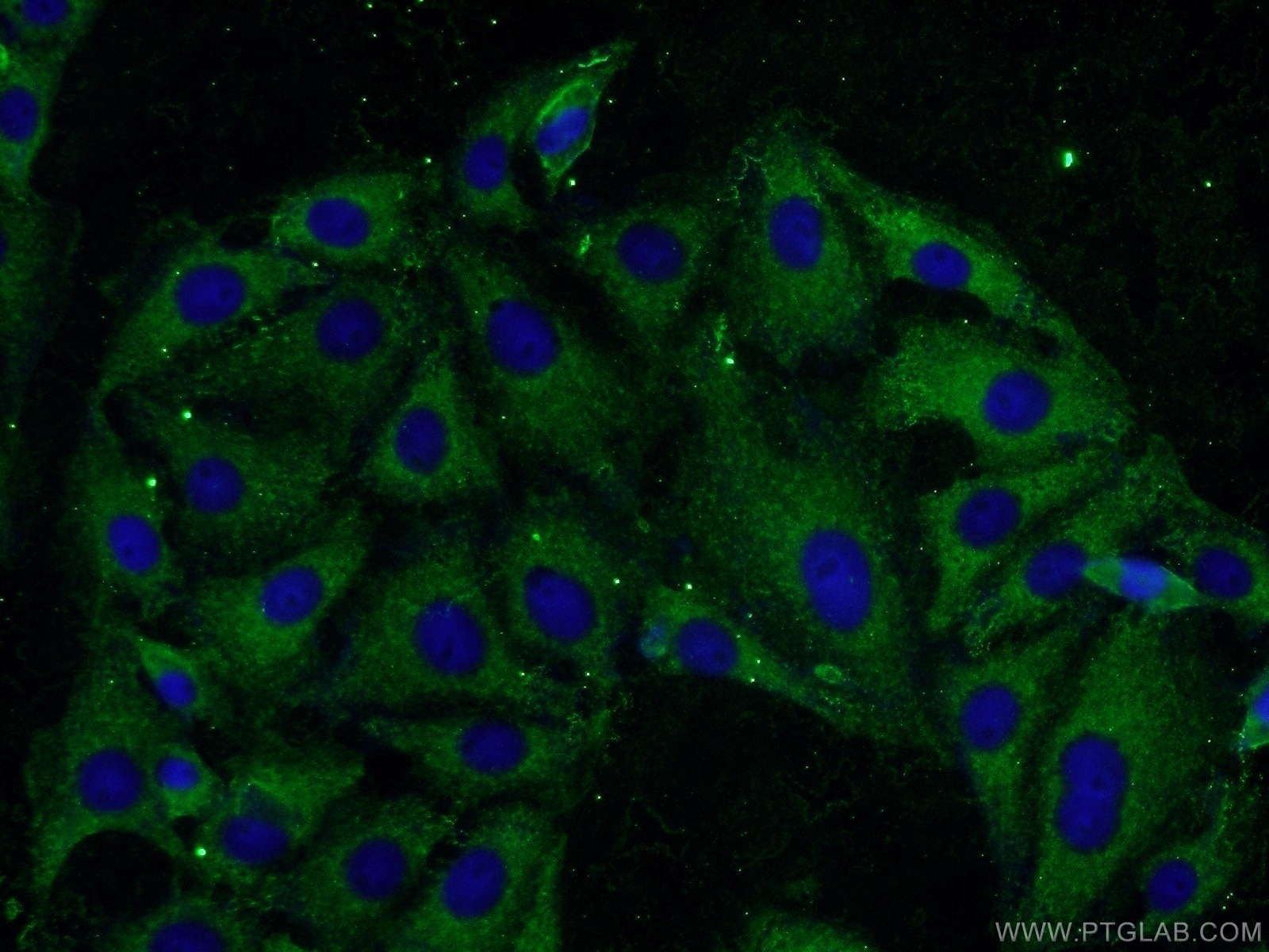 IF Staining of SH-SY5Y using 60316-1-Ig