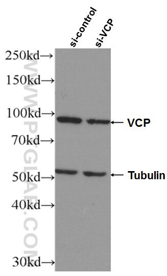 Western Blot (WB) analysis of HeLa cells using VCP Monoclonal antibody (60316-1-Ig)