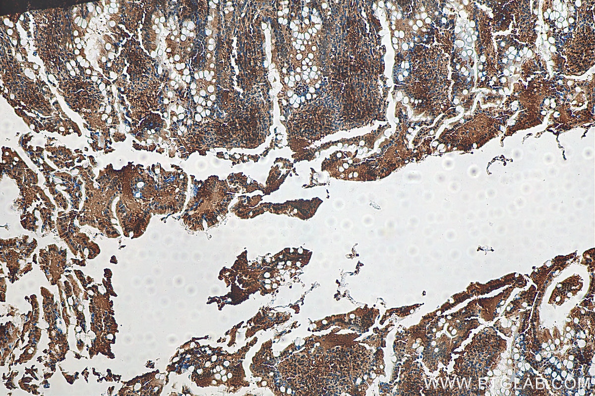 Immunohistochemistry (IHC) staining of rat small intestine tissue using VCP Recombinant antibody (82463-1-RR)