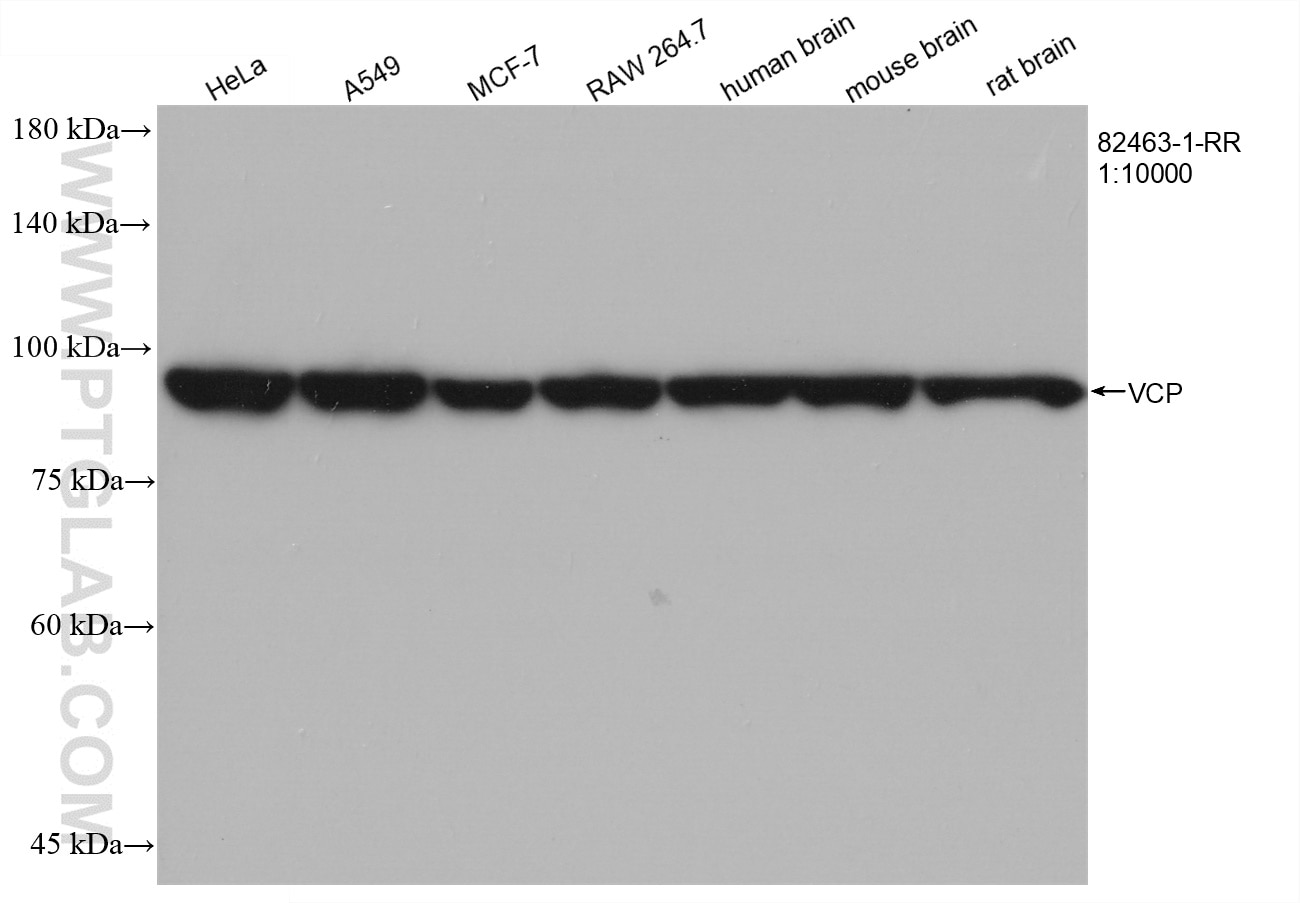 Western Blot (WB) analysis of various lysates using VCP Recombinant antibody (82463-1-RR)