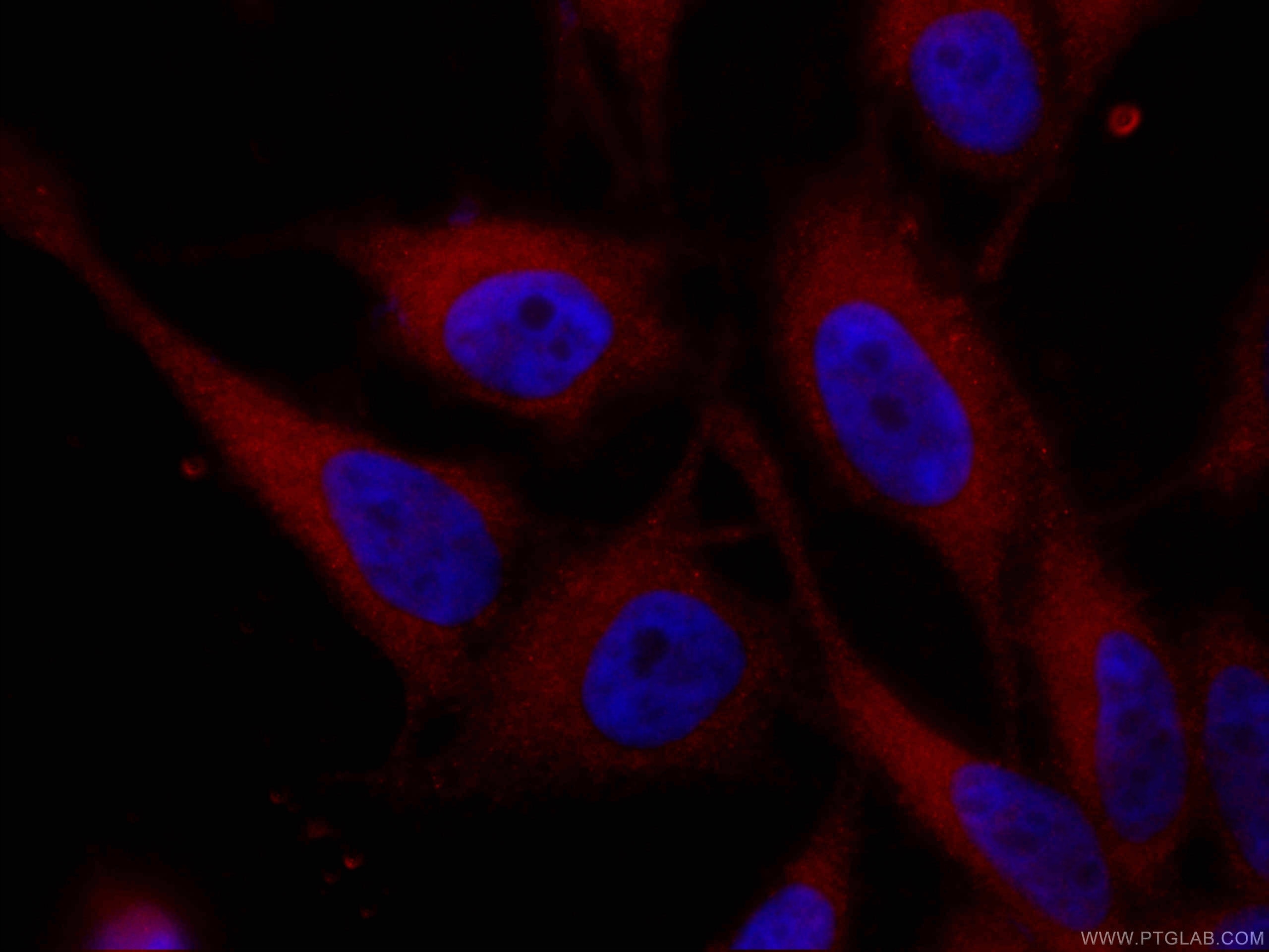 Immunofluorescence (IF) / fluorescent staining of HeLa cells using CoraLite®594-conjugated VCP Monoclonal antibody (CL594-60316)