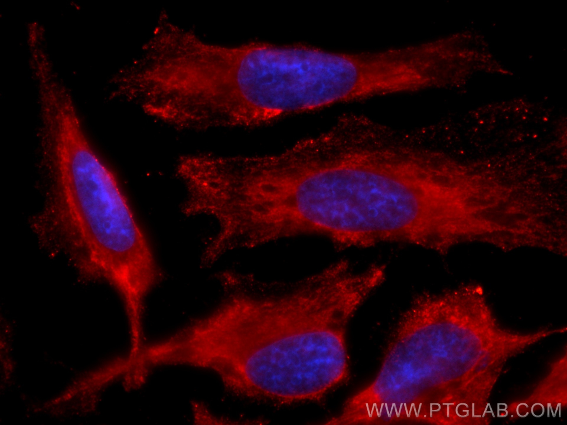 Immunofluorescence (IF) / fluorescent staining of HeLa cells using CoraLite®594-conjugated VCP Monoclonal antibody (CL594-60316)