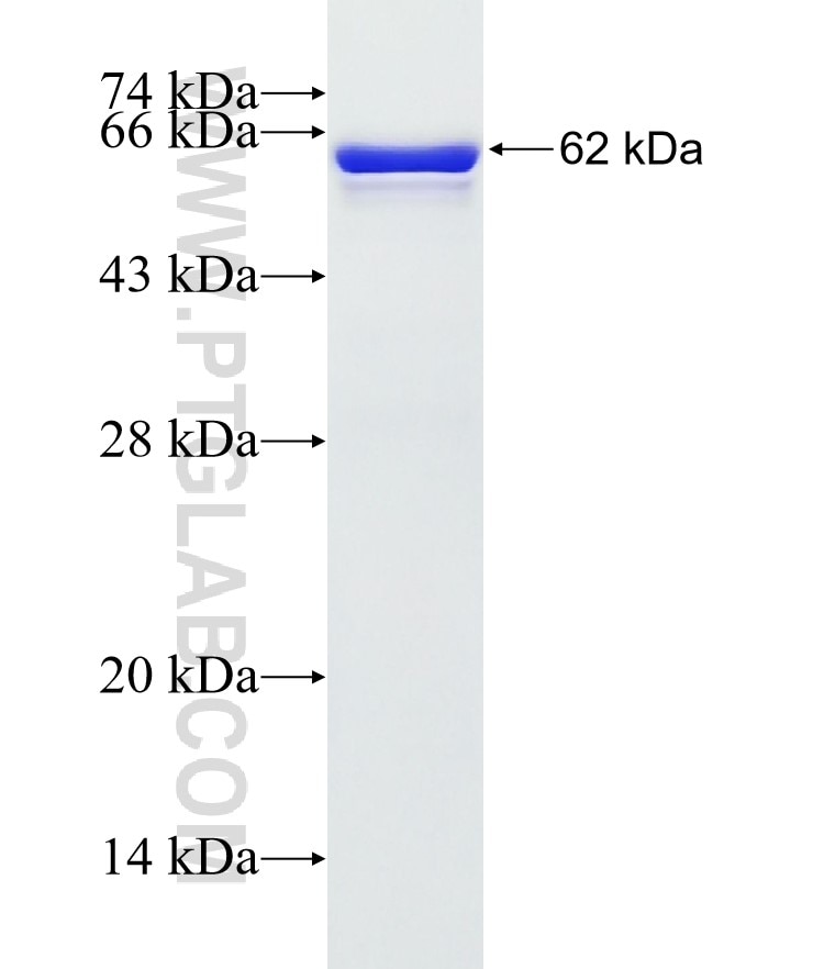 VCP fusion protein Ag1002 SDS-PAGE
